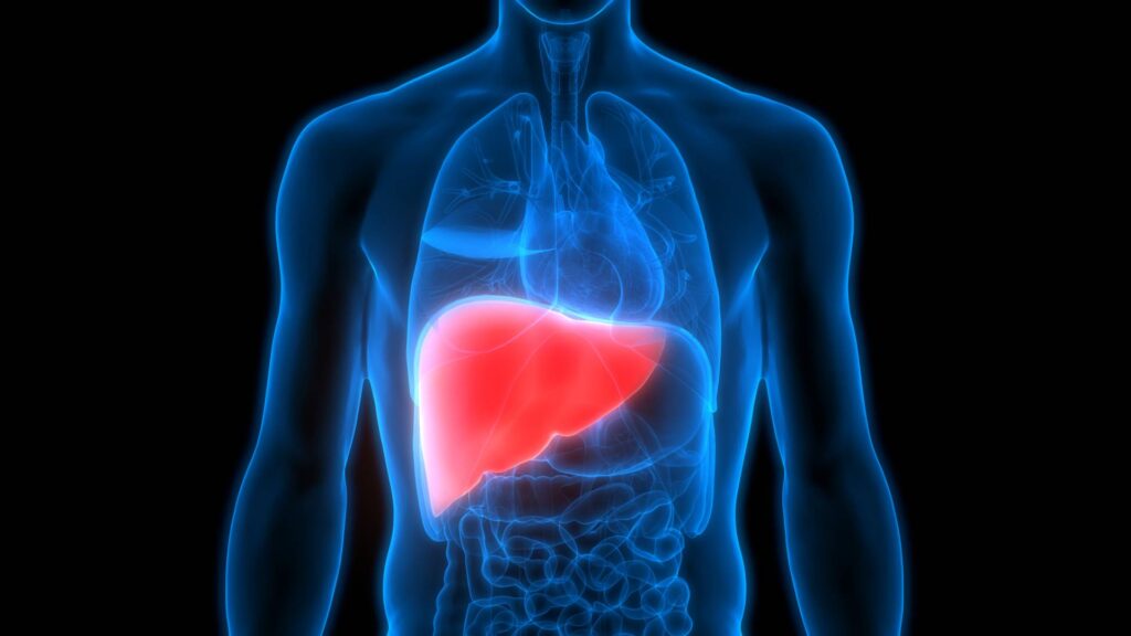 liver transplant